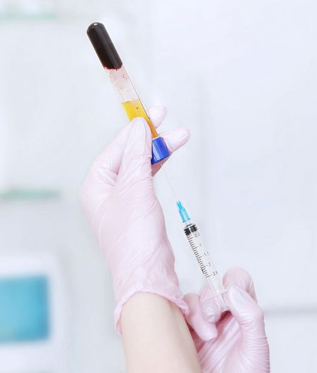 prp-extraction